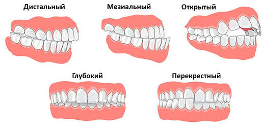 проблемы.jpg