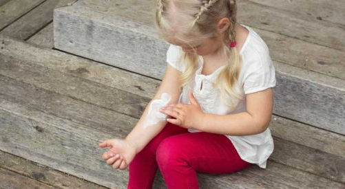 Teaching Your Child How to Manage Eczema