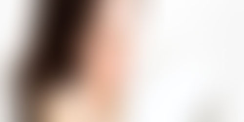 Baumann Skin Type® DSNW: What You Need to Know