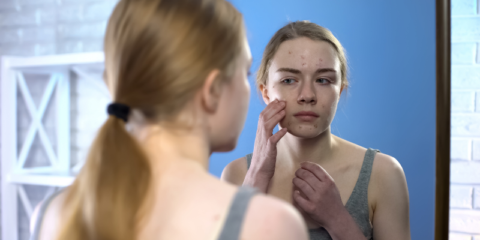 Why Does Puberty Cause Acne?