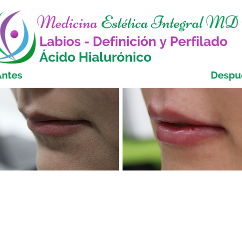 Labios.png
