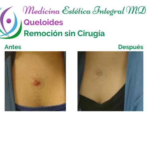 Cicatriz 1.png