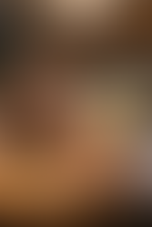 傳統中醫與癡呆症:探索古老智慧的現代應用