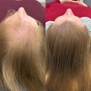 Female SMP Density Treatment