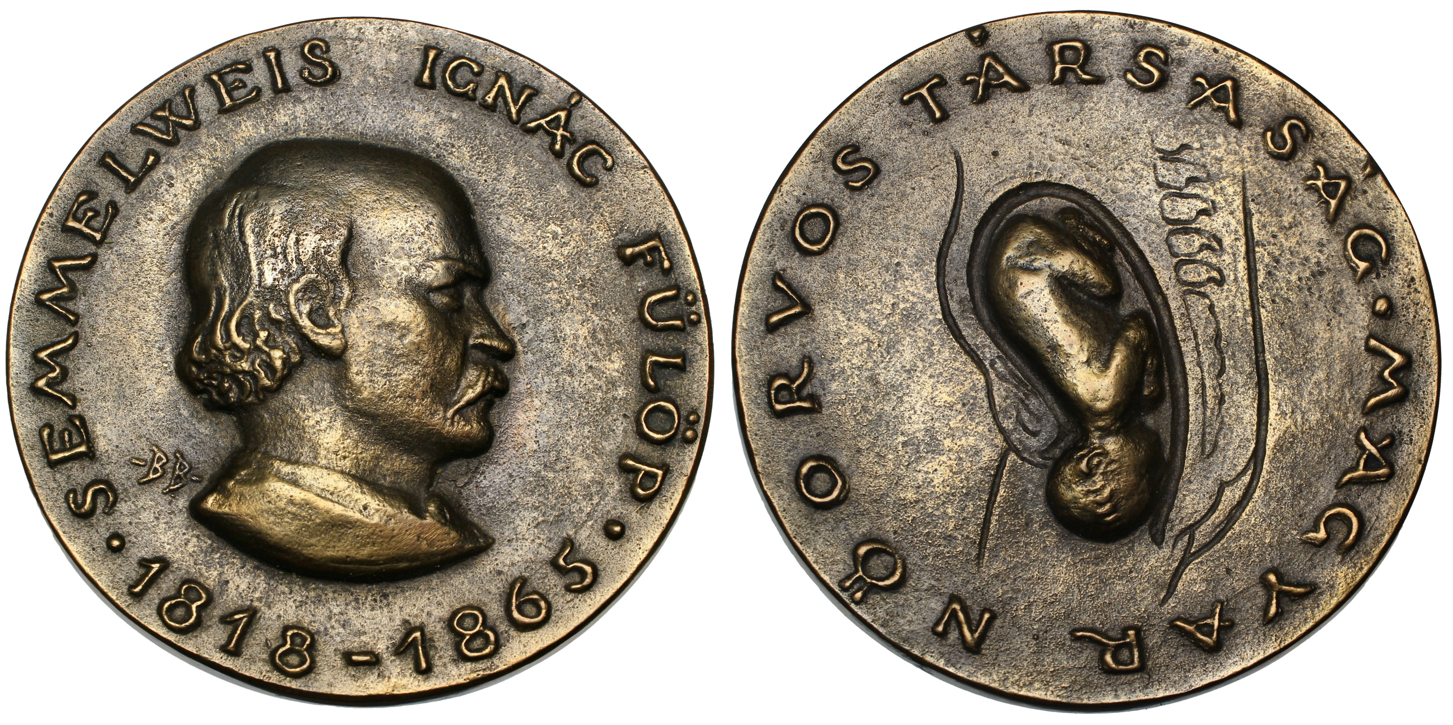 101918 | HUNGARY. Semmelweis Ignác cast bronze Medal.