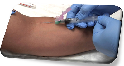Venipuncture Technique