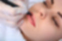 Lip Liner procedure, Cosmetic Tattooing By Helen in Gold Coast