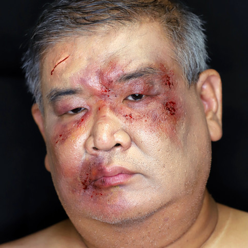 Special Effect Makeup Injury by Nikoru Nicole