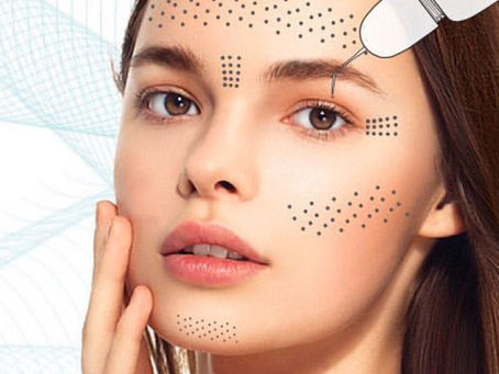Trẻ hoá da bằng plasma là gì? Nguyên lý hoạt động?
