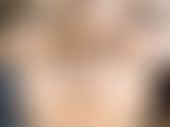 Nâng mũi bị hơi lệch phải làm sao?