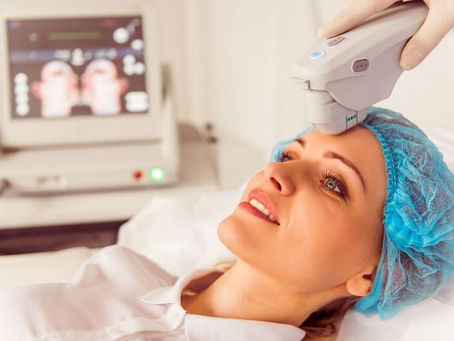 Trẻ hóa da bằng Ultherapy: Là gì? Quy trình thực hiện? Kết quả?