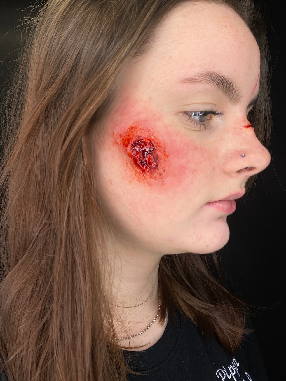 Prosthetic Wound