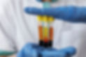 front-view-doctor-holding-vials-prp-treatment.jpg