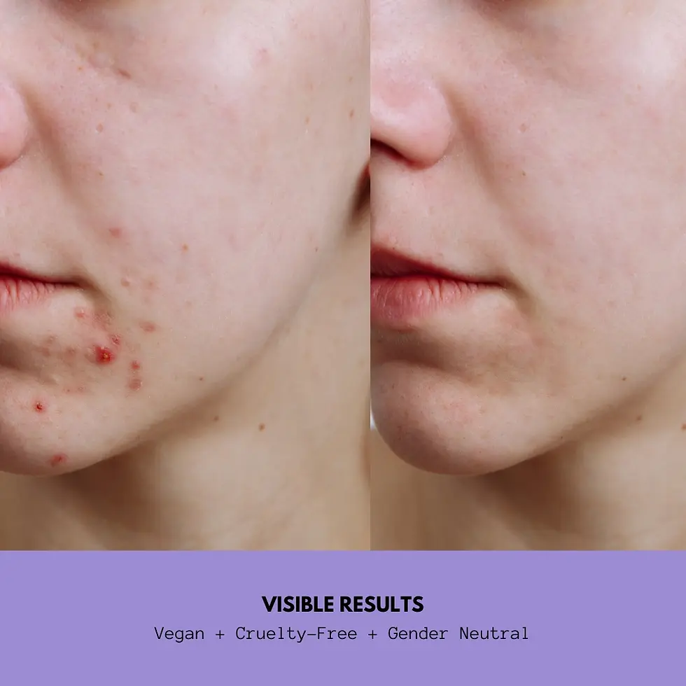 Thumbnail: Charcoal Purple Face Mask