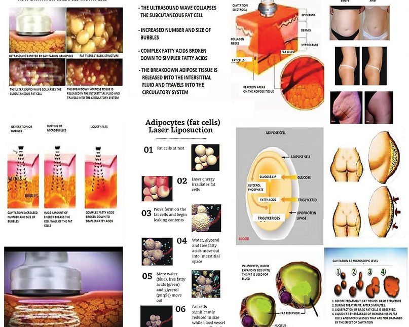 bodyshaping