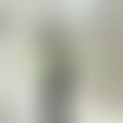 川西市で反り腰が気になる方へ｜ヒップリフトで整える姿勢と体のバランス