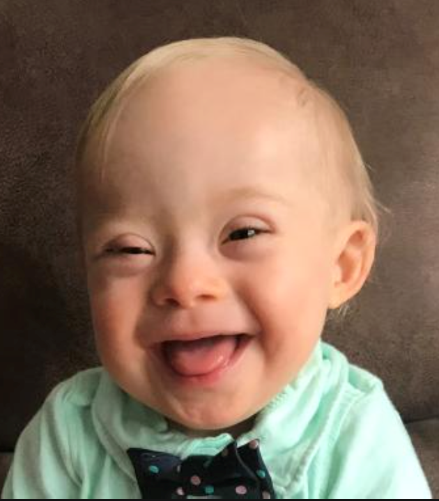 Gerber Baby with Down Syndrome