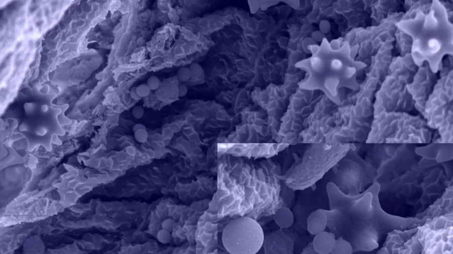 Genetic Bladder: Microbes Can Produce Human DNA Antecedents From Urine