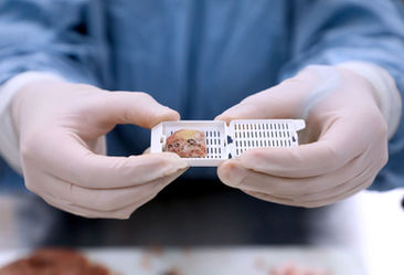 Diagnóstico oportuno y atención multidisciplinaria, claves en el tratamiento exitoso del sarcoma