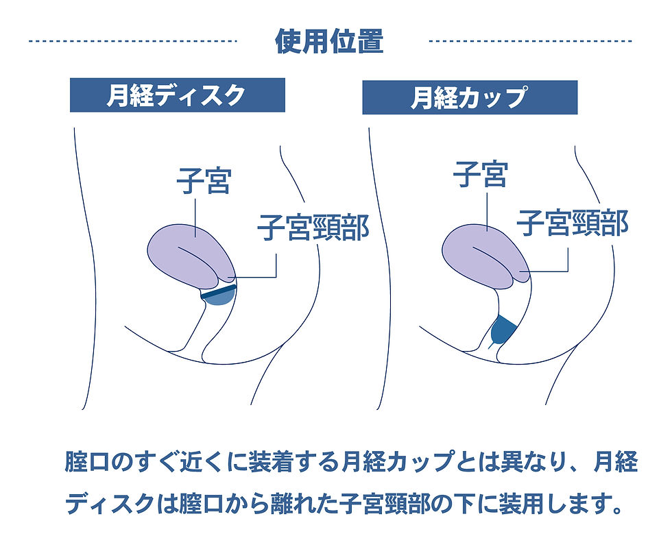 サムネイル： フルムーンディスク スモール