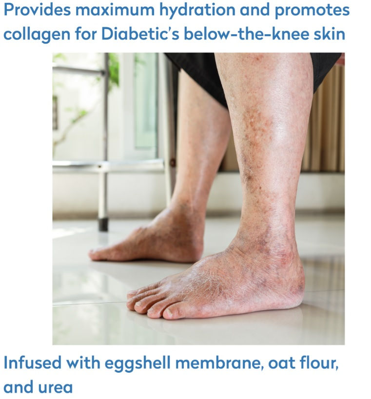Thumbnail: Diabetic Skin Care Cream