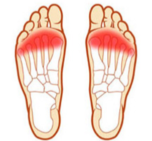 Forefoot Pain