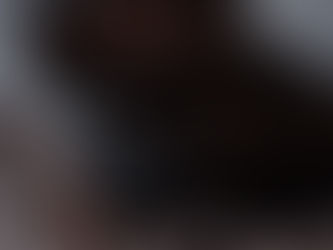 🖤 Why Preventative Botox is the New Skincare Staple in Your 30s