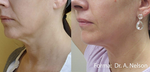 forma-before-after-dr-a-nelson-preview-1.jpg