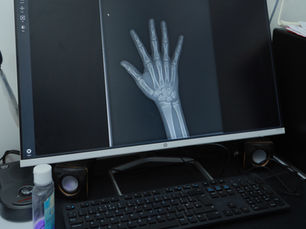 Discover the Benefits of Our New State of the Art X Ray Machine and Expert Radiologists