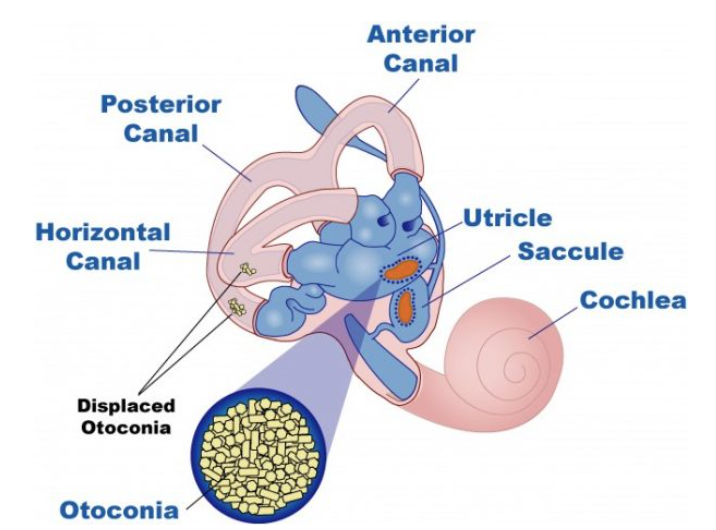 Vestibular Rehabilitation