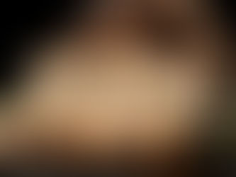 Should we Supplement Vitamin D?