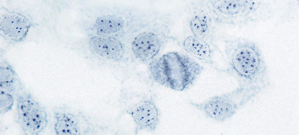 Miniatura: ANA Colorzyme 10 laminas × 7 wells - Immuno Concepts