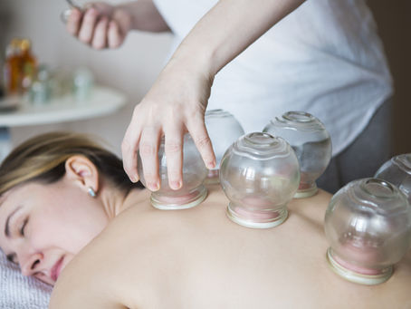 Why you should try cupping