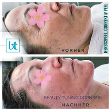 BeautyTuningDornbirn, Schälkur