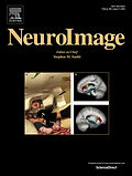 Neuroimage_22.jpeg