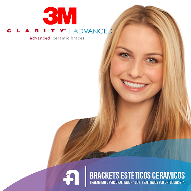 ceramico-web.png