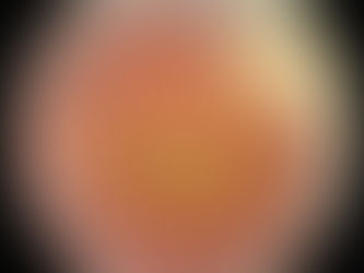 Fundus Flavimaculatus