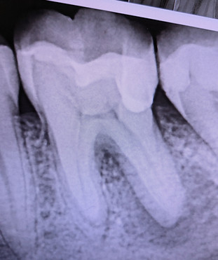 PXL_20250725_181523937.jpg