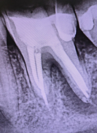 PXL_20250725_181500322.MP.jpg