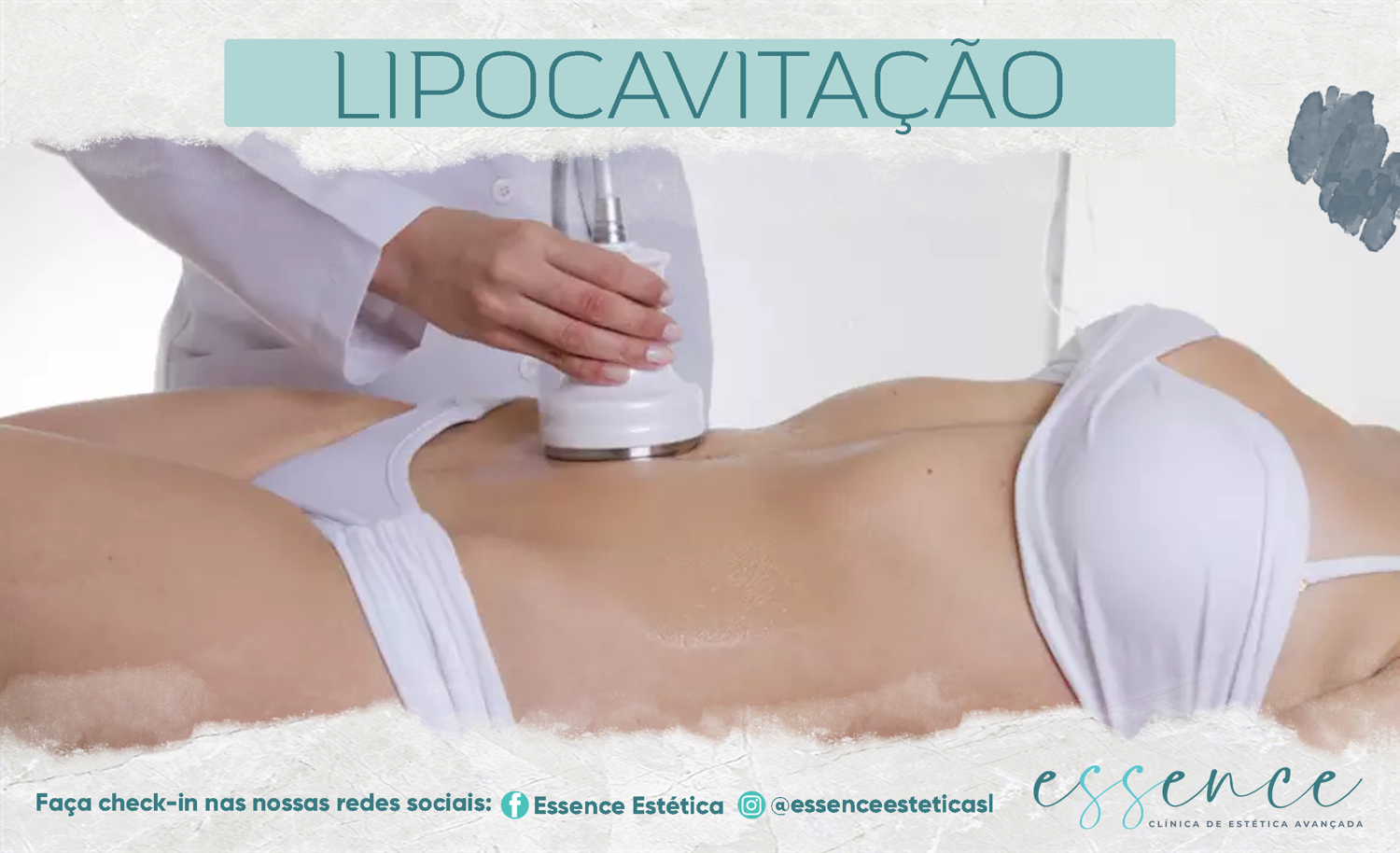 Lipocavity/Lipocavitação (10 sessões)