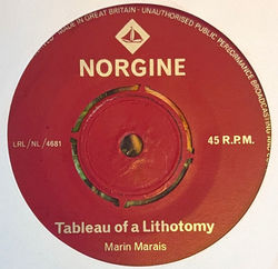 Tableau Of Lithotomy