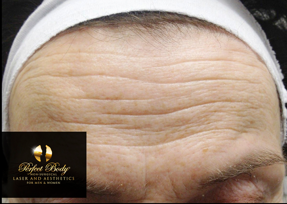 Client: Perfectbodylaser