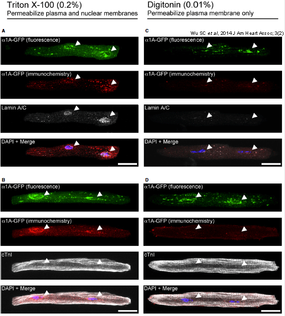 Wu-JAHA-2014-Fig-5.gif