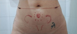 Memorias uterinas