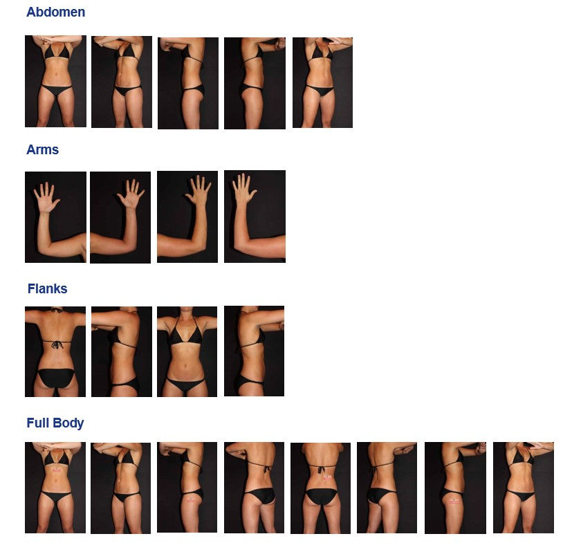 before and after photos | photo scripts