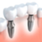 iStock_000060446132_2.jpg