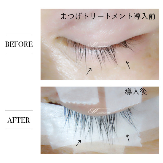 まつげ美容液 まつげトリートメント 自まつげ 細い 短い 抜けている