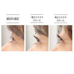 あなたはCカール派？Dカール派？（矯正エクステ）