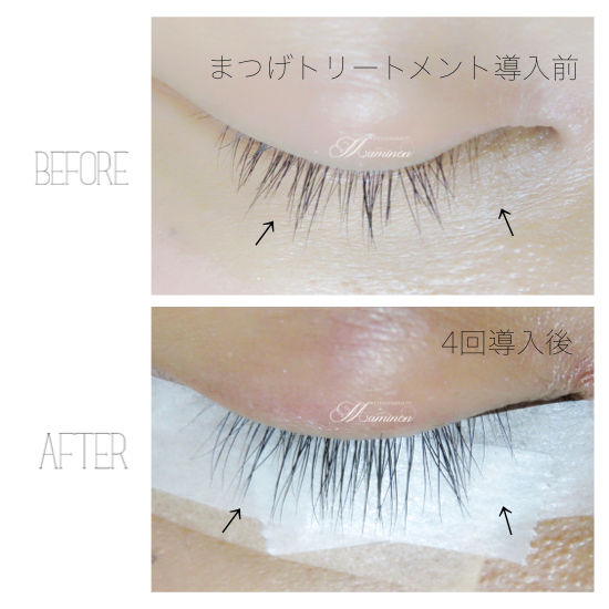 サロンで行うまつげトリートメントの効果