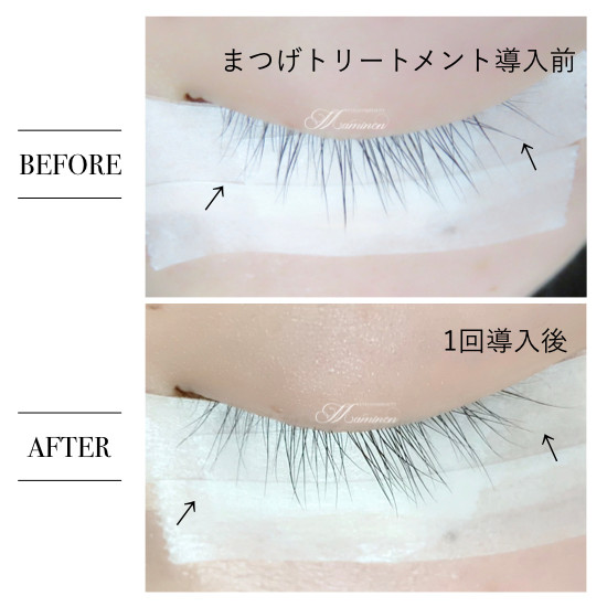 まつげトリートメント 美容液 細い 短い 長くなりたい